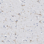 Anti-FCER1G Antibody