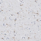 Immunohistochemical staining of human cerebral cortex shows moderate membranous and cytoplasmic positivity in glial cells.