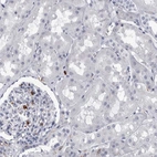 Immunohistochemical staining of human kidney shows no positivity in cells in tubules as expected.