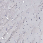 Immunohistochemical staining of human skeletal muscle shows no positivity in myocytes as expected.