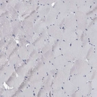 Immunohistochemical staining of human skeletal muscle shows no positivity in myocytes as expected.