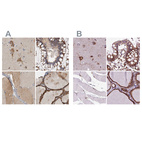 Anti-GANAB Antibody