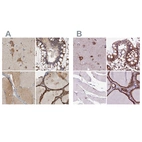 Immunohistochemical staining of human cerebral cortex, colon, skeletal muscle and thyroid gland using Anti-GANAB antibody HPA026874 (A) shows similar protein distribution across tissues to independent antibody HPA061426 (B).