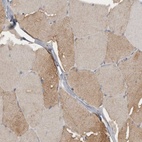 Immunohistochemical staining of human skeletal muscle shows low expression as expected.