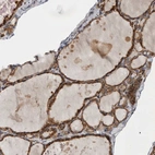 Immunohistochemical staining of human thyroid gland shows high expression.