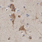 Anti-GANAB Antibody