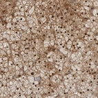 Anti-RTP2 Antibody