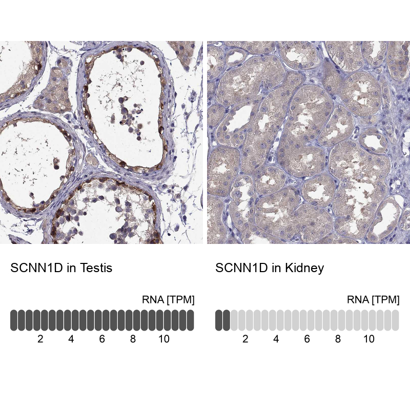 Anti-SCNN1D Antibody