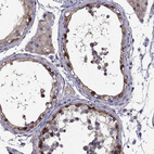 Anti-SCNN1D Antibody