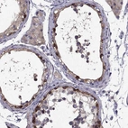 Immunohistochemical staining of human testis shows moderate membranous/cytoplasmic positivity in cells in seminiferous ducts and weak cytoplasmic positivity in Leydig cells.