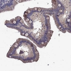 Immunohistochemical staining of human small intestine shows moderate membranous/cytoplasmic positivity in glandular cells and goblet cells.