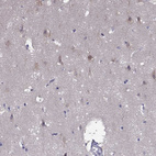 Immunohistochemical staining of human cerebral cortex shows weak cytoplasmic/membranous positivity in neurons.