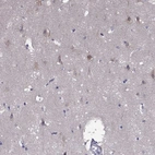 Immunohistochemical staining of human cerebral cortex shows weak cytoplasmic/membranous positivity in neurons.