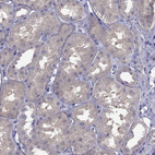 Anti-SCNN1D Antibody