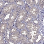 Immunohistochemical staining of human kidney shows weak cytoplasmic positivity in cells in tubules.
