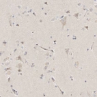 Immunohistochemical staining of human cerebral cortex shows granular cytoplasmic positivity in neurons.