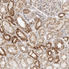 Immunohistochemical staining of human kidney shows moderate to strong granular cytoplasmic positivity in cells in tubules.