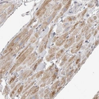Immunohistochemical staining of human heart muscle shows moderate granular cytoplasmic positivity.
