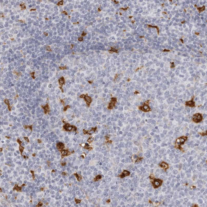 Anti-NCEH1 Antibody