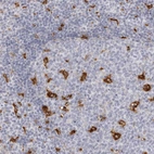 Anti-NCEH1 Antibody