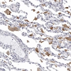 Immunohistochemical staining of human lung shows moderate cytoplasmic positivity in macrophages.