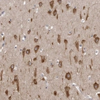 Immunohistochemical staining of human hippocampus shows strong cytoplasmic positivity in neuronal cells.