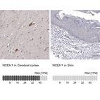 Immunohistochemistry analysis in human cerebral cortex and skin tissues using HPA026888 antibody. Corresponding NCEH1 RNA-seq data are presented for the same tissues.