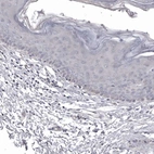 Immunohistochemical staining of human skin shows no positivity in squamous epithelial cells as expected.