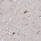 Immunohistochemical staining of human cerebral cortex shows strong cytoplasmic positivity in neuronal cells.