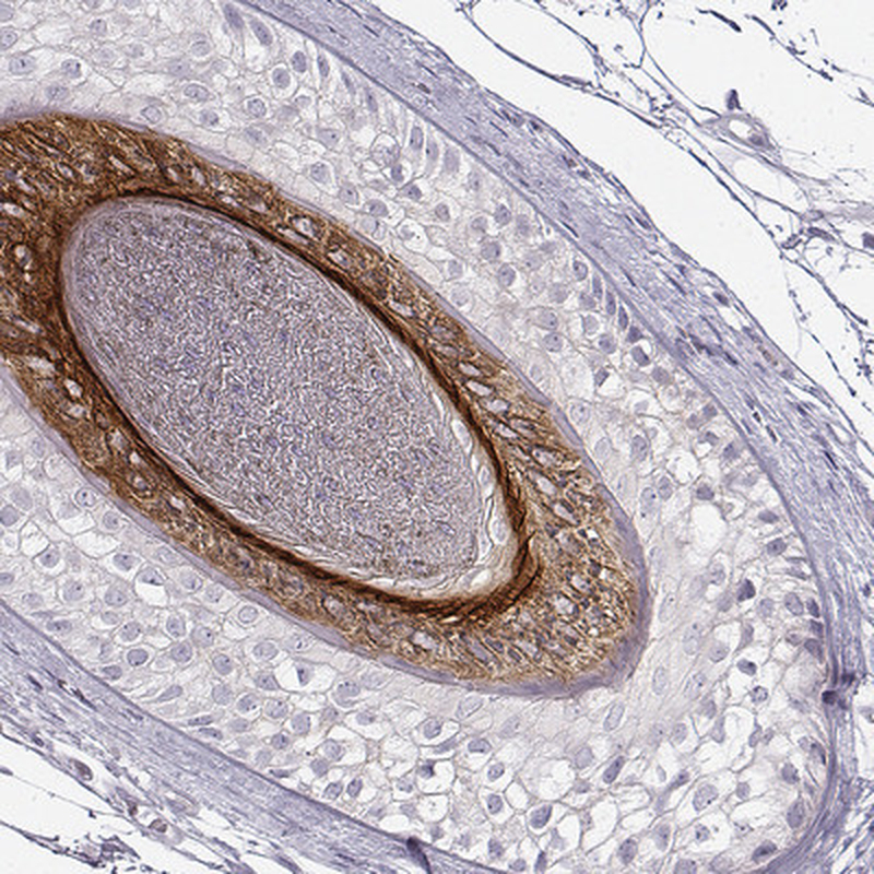Anti-KRT26 Antibody