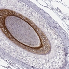 Anti-KRT26 Antibody