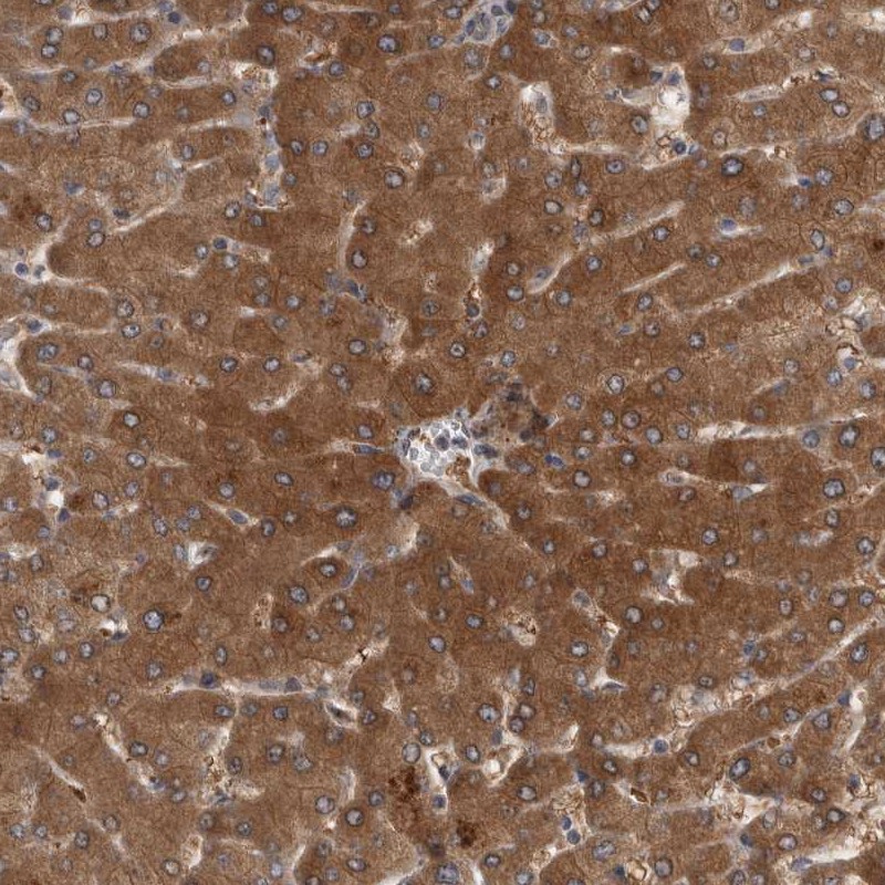 Anti-PARP11 Antibody