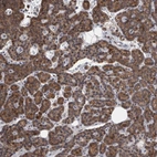 Immunohistochemical staining of human parathyroid gland shows high expression.