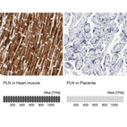 Anti-PLN Antibody