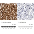 Anti-PLN Antibody