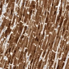 Immunohistochemical staining of human heart muscle shows strong cytoplasmic positivity in cardiomyocytes.