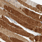 Immunohistochemical staining of human skeletal muscle shows strong cytoplasmic positivity in myocytes.
