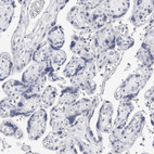 Immunohistochemical staining of human placenta shows no positivity in trophoblastic cells as expected.