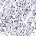 Immunohistochemical staining of human placenta shows no positivity in trophoblastic cells as expected.