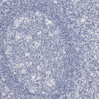 Immunohistochemical staining of human tonsil shows no positivity in germinal center cells as expected.
