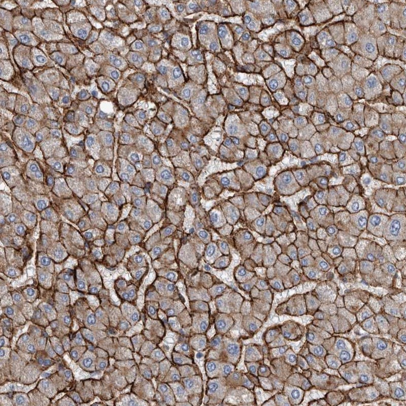 Anti-GLT8D2 Antibody