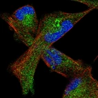 Immunofluorescent staining of human cell line RH-30 shows localization to cytosol.