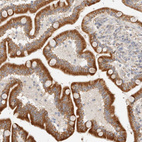 Anti-C12orf49 Antibody