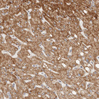 Immunohistochemical staining of human liver shows strong granular cytoplasmic positivity in hepatocytes.