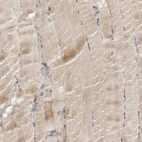 Immunohistochemical staining of human skeletal muscle shows weak cytoplasmic positivity in myocytes.