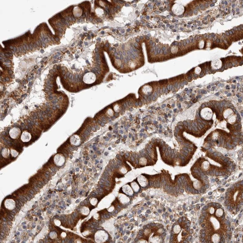 Anti-C4orf3 Antibody