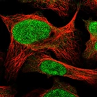 Immunofluorescent staining of human cell line U-2 OS shows localization to nucleoplasm.