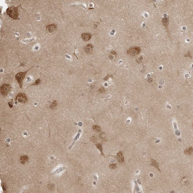 Anti-YWHAG Antibody