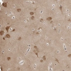 Anti-YWHAG Antibody