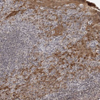 Immunohistochemical staining of human tonsil shows strong cytoplasmic positivity in squamous epithelial cells.